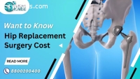 Hip Replacement Cost