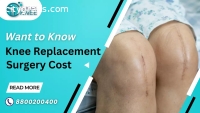 Knee Replacement Surgery Cost in Delhi