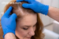 Non- Surgical Hair Replacement Dallas