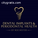 Permanent Dentures in Rochester NY