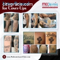 Tattoo Removal for Cover-ups - Medermis